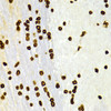 Immunohistochemistry of paraffin-embedded Rat brain using DiMethyl-Histone H3-K27 Polyclonal Antibody at dilution of  1:100 (40x lens).