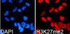 Immunofluorescence analysis of 293T cells using DiMethyl-Histone H3-K27 Polyclonal Antibody