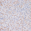 Immunohistochemistry of paraffin-embedded Rat ovary using TriMethyl-Histone H3-K27 Polyclonal Antibody at dilution of  1:100 (40x lens).