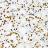 Immunohistochemistry of paraffin-embedded Human stomach using TriMethyl-Histone H3-K27 Polyclonal Antibody at dilution of  1:100 (40x lens).