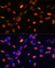 Immunofluorescence analysis of NIH/3T3 cells using TriMethyl-Histone H3-K27 Polyclonal Antibody at dilution of  1:100. Blue: DAPI for nuclear staining.