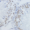 Immunohistochemistry of paraffin-embedded Rat testis using DiMethyl-Histone H3-K36 Polyclonal Antibody at dilution of  1:200 (40x lens).