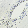 Immunohistochemistry of paraffin-embedded Human breast using TriMethyl-Histone H3-K36 Polyclonal Antibody at dilution of  1:200 (40x lens).