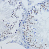 Immunohistochemistry of paraffin-embedded Rat testis using TriMethyl-Histone H3-K36 Polyclonal Antibody at dilution of  1:200 (40x lens).