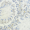 Immunohistochemistry of paraffin-embedded Mouse testis using TriMethyl-Histone H3-K36 Polyclonal Antibody at dilution of  1:200 (40x lens).