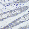 Immunohistochemistry of paraffin-embedded Human colon using MonoMethyl-Histone H4-K20 Polyclonal Antibody at dilution of  1:200 (40x lens).