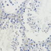 Immunohistochemistry of paraffin-embedded Mouse testis using DiMethyl-Histone H4-K20 Polyclonal Antibody at dilution of  1:200 (40x lens).