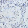 Immunohistochemistry of paraffin-embedded Mouse testis using TriMethyl-Histone H4-K20 Polyclonal Antibody at dilution of  1:200 (40x lens).