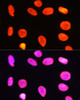 Immunofluorescence analysis of C6 cells using Symmetric DiMethyl-Histone H3-R2 Polyclonal Antibody at dilution of  1:100 (40x lens). Blue: DAPI for nuclear staining.