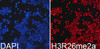 Immunofluorescence analysis of 293T cells using Asymmetric DiMethyl-Histone H3-R26 Polyclonal Antibody