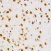 Immunohistochemistry of paraffin-embedded Rat brain using Asymmetric DiMethyl-Histone H4-R3 Polyclonal Antibody at dilution of  1:200 (40x lens).