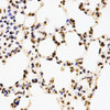Immunohistochemistry of paraffin-embedded Mouse lung using Asymmetric DiMethyl-Histone H3-R17 Polyclonal Antibody at dilution of  1:200 (40x lens).