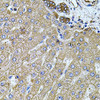 Immunohistochemistry of paraffin-embedded Human liver damage using FLNB Polyclonal Antibody at dilution of  1:100 (40x lens).