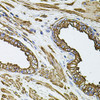 Immunohistochemistry of paraffin-embedded Human prostate using FLNB Polyclonal Antibody at dilution of  1:100 (40x lens).