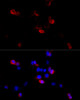 Immunofluorescence analysis of HeLa cells using FLNB Polyclonal Antibody at dilution of  1:100 (40x lens). Blue: DAPI for nuclear staining.