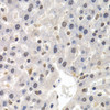 Immunohistochemistry of paraffin-embedded Rat liver using GTF2F1 Polyclonal Antibody at dilution of  1:200 (40x lens).