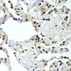 Immunohistochemistry of paraffin-embedded Human normal lung using GTF2F1 Polyclonal Antibody at dilution of  1:200 (40x lens).