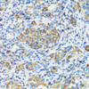 Immunohistochemistry of paraffin-embedded Rat ovary using APOBEC3F Polyclonal Antibody at dilution of  1:100 (40x lens).