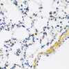 Immunohistochemistry of paraffin-embedded Mouse lung using APOBEC3F Polyclonal Antibody at dilution of  1:100 (40x lens).