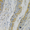 Immunohistochemistry of paraffin-embedded Human colon carcinoma using GNAO1 Polyclonal Antibody at dilution of  1:100 (40x lens).