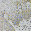 Immunohistochemistry of paraffin-embedded Human esophagus using GNAO1 Polyclonal Antibody at dilution of  1:100 (40x lens).