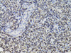 Immunohistochemistry of paraffin-embedded Human tonsil using TMPO Polyclonal Antibody at dilution of  1:100 (40x lens).