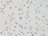 Immunohistochemistry of paraffin-embedded Mouse brain using TMPO Polyclonal Antibody at dilution of  1:100 (40x lens).