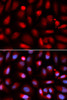 Immunofluorescence analysis of U2OS cells using NF-kB p65 Polyclonal Antibody