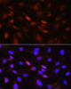 Immunofluorescence analysis of C6 cells using PLK1 Polyclonal Antibody at dilution of  1:100 (40x lens). Blue: DAPI for nuclear staining.