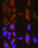 Immunofluorescence analysis of U-2 OS cells using PLK1 Polyclonal Antibody at dilution of  1:100 (40x lens). Blue: DAPI for nuclear staining.