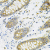 Immunohistochemistry of paraffin-embedded Human colon using RANKL Polyclonal Antibody at dilution of  1:100 (40x lens).