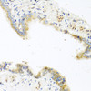 Immunohistochemistry of paraffin-embedded Mouse lung using RETN Polyclonal Antibody at dilution of  1:100 (40x lens).