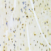 Immunohistochemistry of paraffin-embedded Mouse heart using HMGB1 Polyclonal Antibody at dilution of  1:100 (40x lens).