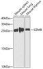 Western blot analysis of extracts of various cell lines using GZMB Polyclonal Antibody at dilution of 1:1000.