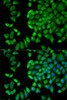 Immunofluorescence analysis of HeLa cells using WNK1 Polyclonal Antibody