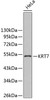 Western blot analysis of extracts of HeLa cells using KRT7 Polyclonal Antibody.