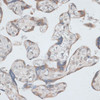 Immunohistochemistry of paraffin-embedded Human placenta using KRT7 Polyclonal Antibody at dilution of  1:100 (40x lens).