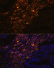 Immunofluorescence analysis of Human lung cancer cells using KRT7 Polyclonal Antibody at dilution of  1:100. Blue: DAPI for nuclear staining.
