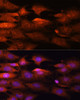 Immunofluorescence analysis of C6 cells using N-WASP Polyclonal Antibody at dilution of  1:100 (40x lens). Blue: DAPI for nuclear staining.