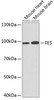 Western blot analysis of extracts of various cell lines using FES Polyclonal Antibody at dilution of 1:1000.