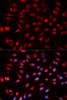 Immunofluorescence analysis of HeLa cells using APEX1 Polyclonal Antibody