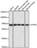 Western blot analysis of extracts of various cell lines using SYVN1 Polyclonal Antibody at dilution of 1:1000.