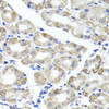 Immunohistochemistry of paraffin-embedded Human stomach using MAPKBP1 Polyclonal Antibody at dilution of  1:100 (40x lens).