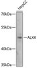 Western blot analysis of extracts of HepG2 cells using ALX4 Polyclonal Antibody at dilution of 1:3000.