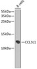 Western blot analysis of extracts of B-cell cells using CCL3L1 Polyclonal Antibody at dilution of 1:1000.