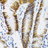 Immunohistochemistry of paraffin-embedded Human stomach using MCT1/SLC16A1 Polyclonal Antibody at dilution of  1:100 (40x lens).