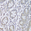 Immunohistochemistry of paraffin-embedded Human colon using CKMT1B Polyclonal Antibody at dilution of  1:150 (40x lens).