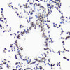 Immunohistochemistry of paraffin-embedded Rat lung using MonoMethyl-Histone H3-R17 Polyclonal Antibody at dilution of  1:100 (40x lens).