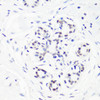 Immunohistochemistry of paraffin-embedded Human breast using MonoMethyl-Histone H3-R17 Polyclonal Antibody at dilution of  1:100 (40x lens).