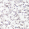 Immunohistochemistry of paraffin-embedded Mouse kidney using MonoMethyl-Histone H3-R17 Polyclonal Antibody at dilution of  1:100 (40x lens).
